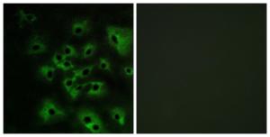 Immunofluorescence analysis of HeLa cells, treated with EGF 200nM 5', using Anti-HER4 (phospho Tyr1284) Antibody. The right hand panel represents a negative control, where the antibody was pre-incubated with the immunising peptide