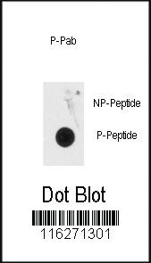 Anti-MECP2 Rabbit Polyclonal Antibody