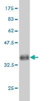 Anti-KLF9 Mouse Monoclonal Antibody [clone: 1H5]