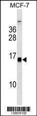 Anti-HIST2H2BE Rabbit Polyclonal Antibody