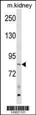 Anti-ARHGEF16 Rabbit Polyclonal Antibody (AP (Alkaline Phosphatase))