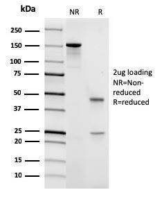 SDS-PAGE analysis of Anti-CD45 Antibody [rPTPRC/1461] under non-reduced and reduced conditions; showing intact IgG and intact heavy and light chains, respectively. SDS-PAGE analysis confirms the integrity and purity of the antibody.