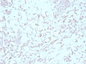 Immunohistochemical analysis of formalin-fixed, paraffin-embedded human liver using Anti-Kindlin 1 Antibody [4A514]