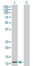 Anti-MSRB1 Mouse Polyclonal Antibody