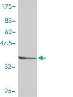 Anti-AP1S1 Mouse Polyclonal Antibody