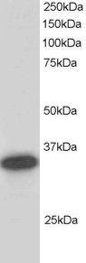 Anti-CBR1 Goat Polyclonal Antibody