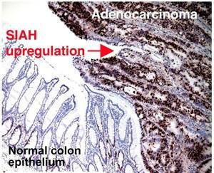 Anti-LANA2 Mouse Monoclonal Antibody (DyLight® 650) [clone: CM-A807]