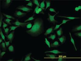 Anti-PBK Mouse Monoclonal Antibody [clone: 4A10]