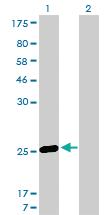 Anti-MS4A7 Mouse Monoclonal Antibody [clone: 2D3]