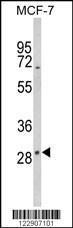 Anti-DIO2 Rabbit Polyclonal Antibody (HRP (Horseradish Peroxidase))