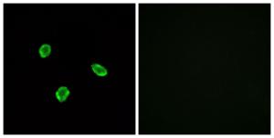 Antibody anti-SSTR1 A96030-100 100 µg