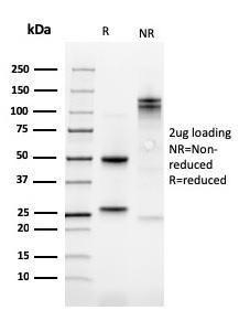 SDS-PAGE analysis of Anti-Kindlin 1 Antibody [4A514] under non-reduced and reduced conditions; showing intact IgG and intact heavy and light chains, respectively SDS-PAGE analysis confirms the integrity and purity of the antibody