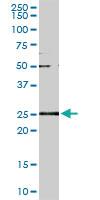 Anti-GSTA2 Mouse Monoclonal Antibody [clone: 3D4]