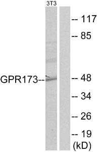 Western blot analysis of lysates from NIH/3T3 cells using Anti-GPR173 Antibody The right hand lane represents a negative control, where the antibody is blocked by the immunising peptide