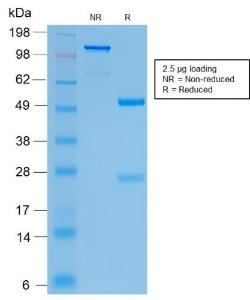 SDS-PAGE analysis of Anti-CFTR Antibody [CFTR/2290R] under non-reduced and reduced conditions; showing intact IgG and intact heavy and light chains, respectively. SDS-PAGE analysis confirms the integrity and purity of the antibody.