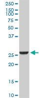 Anti-GSTA2 Mouse Monoclonal Antibody [clone: 3D4]