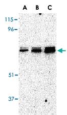 Anti-EIF2AK2 Rabbit Polyclonal Antibody