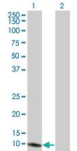 Anti-MSRB1 Mouse Monoclonal Antibody [clone: 8B2]