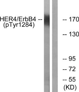 Western blot analysis of lysates from HUVEC cells treated with EGF 200ng/ml 30' using Anti-HER4 (phospho Tyr1284) Antibody. The right hand lane represents a negative control, where the antibody is blocked by the immunising peptide