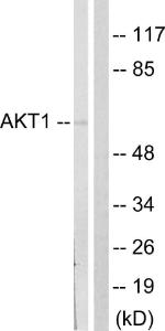 Western blot analysis of lysates from NIH/3T3 cells, treated with PDGF 50 ng/ml 20' using Anti-Akt Antibody. The right hand lane represents a negative control, where the antibody is blocked by the immunising peptide