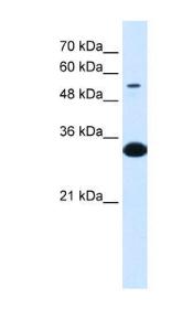 Anti-A1BG Rabbit Polyclonal Antibody