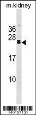 Anti-FGF20 Rabbit Polyclonal Antibody (PE (Phycoerythrin))