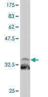 Anti-NKX2-1 Mouse Monoclonal Antibody [clone: 2F6]