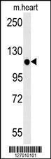 Anti-KIF24 Rabbit Polyclonal Antibody (PE (Phycoerythrin))