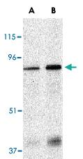 Anti-EIF2AK2 Rabbit Polyclonal Antibody