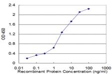 Anti-MSRB1 Mouse Monoclonal Antibody [clone: 8B2]