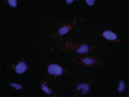 Anti-DNMT1 Antibody Pair