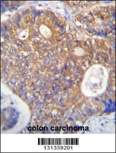 Anti-PAICS Rabbit Polyclonal Antibody (FITC (Fluorescein Isothiocyanate))