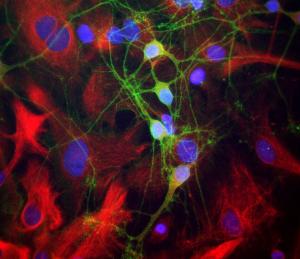 Mixed neuron-glial cultures stained with Anti-a-II Spectrin Antibody (green) and Anti-Nestin Antibody (A85293 / red). The Anti-a-II Spectrin Antibody stains numerous axonal and dendritic profiles in these cultures, clearly revealing the submembraneous cytoskeleton.