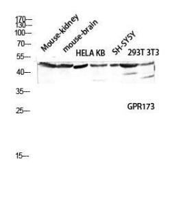 Western blot analysis of mouse kidney, mouse brain, HELA, KB SH, SY5Y, 293T, 3T3 lysis using Anti-GPR173 Antibody