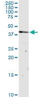 Anti-OXA1L Rabbit Polyclonal Antibody