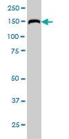 Anti-RAPGEF6 Mouse Monoclonal Antibody [clone: 2C5]