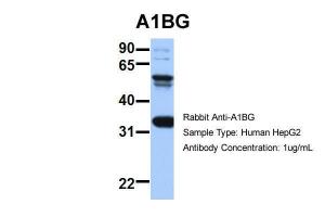 Anti-A1BG Rabbit Polyclonal Antibody