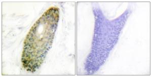 Immunohistochemical analysis of paraffin-embedded human skin using Anti-HDAC3 (phospho Ser424) Antibody. The right hand panel represents a negative control, where the antibody was pre-incubated with the immunising peptide.