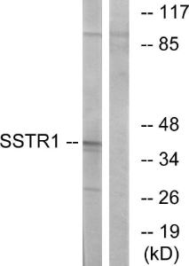 Antibody anti-SSTR1 A96030-100 100 µg