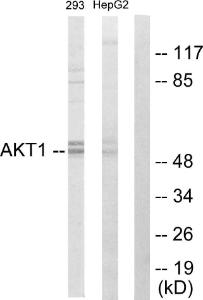 Western blot analysis of lysates from 293 cells and HepG2 cells using Anti-Akt Antibody. The right hand lane represents a negative control, where the antibody is blocked by the immunising peptide