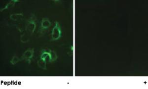 Anti-SCNN1B Rabbit Polyclonal Antibody