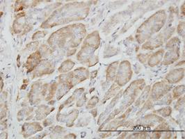 Anti-RAPGEF6 Mouse Monoclonal Antibody [clone: 2C5]