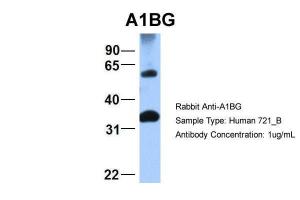 Anti-A1BG Rabbit Polyclonal Antibody