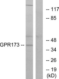 Western blot analysis of lysates from K562 cells using Anti-GPR173 Antibody. The right hand lane represents a negative control, where the antibody is blocked by the immunising peptide