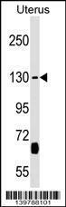 Anti-KIF27 Rabbit Polyclonal Antibody (FITC (Fluorescein Isothiocyanate))