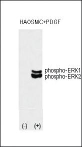 Anti-TLCD2 Rabbit Polyclonal Antibody