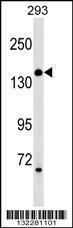 Anti-ARHGEF18 Rabbit Polyclonal Antibody (Biotin)