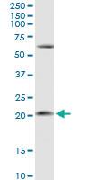 Anti-APRT Rabbit Polyclonal Antibody