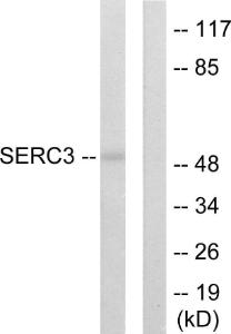 Western blot analysis of lysates from 293 cells using Anti-SERC3 Antibody. The right hand lane represents a negative control, where the antibody is blocked by the immunising peptide