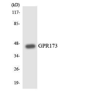 Western blot analysis of the lysates from COLO205 cells using Anti-GPR173 Antibody